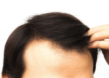 안전하고 저렴한 탈모 솔루션을 제공하는 한국 사이트